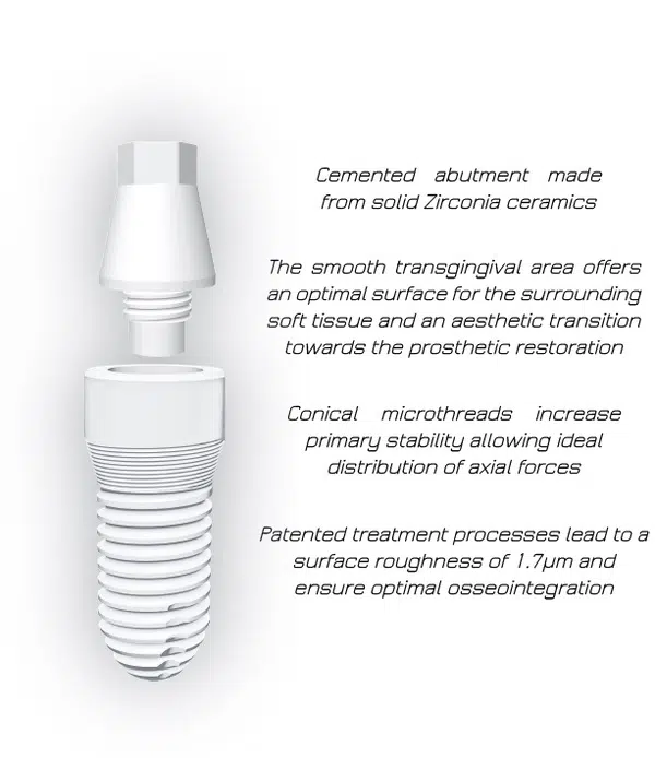 แผนภาพส่วนประกอบรากฟันเทียม Implant Abutment Crown Smile and Shine Dental Clinic