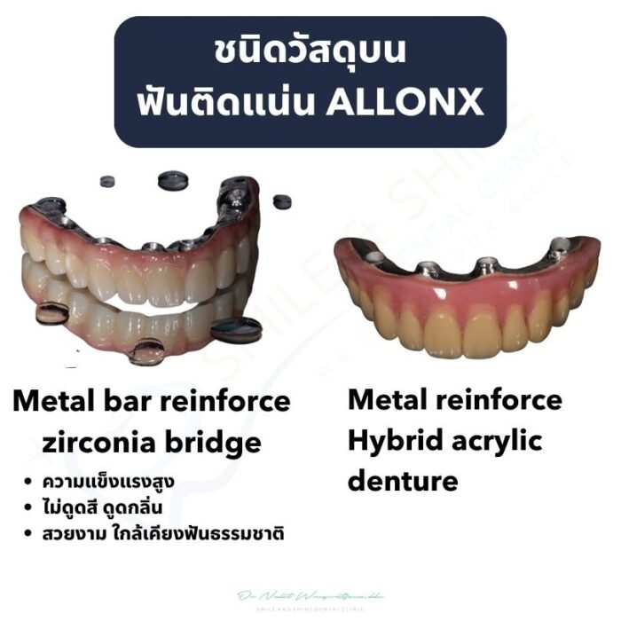 allon4-ceramic