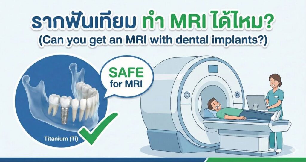 กราฟิกอธิบายความปลอดภัยของการทำรากฟันเทียมไทเทเนียมเมื่อต้องตรวจ MRI แสดงเครื่องสแกนและโครงสร้างฟัน