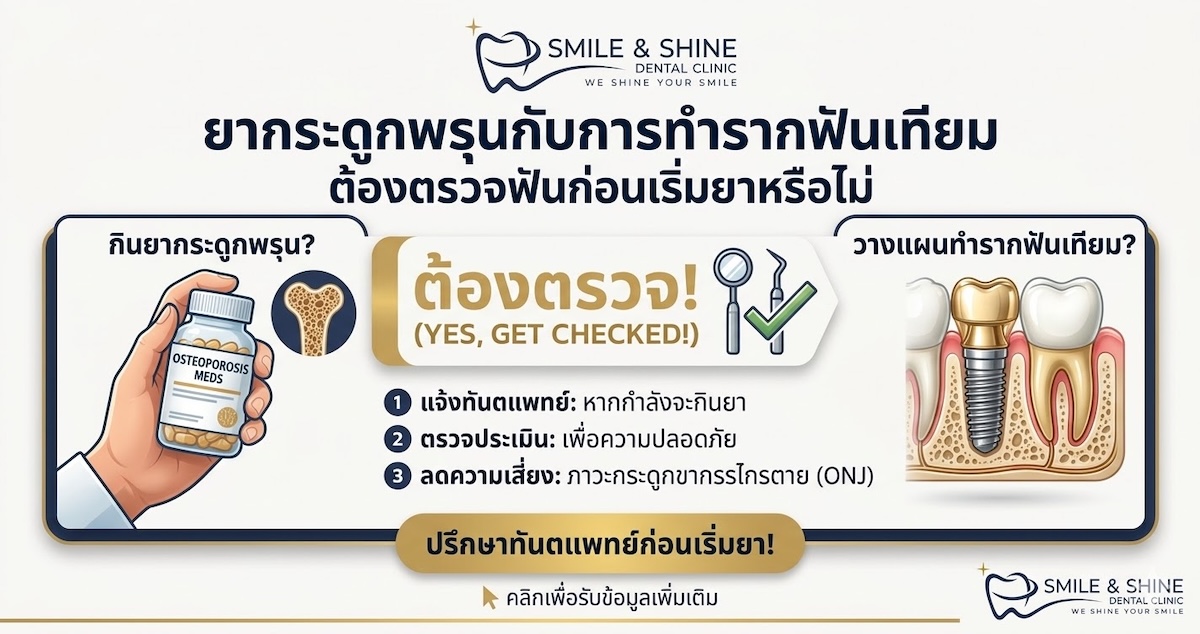 ยากระดูกพรุนกับการทำรากฟันเทียม ทำไมต้องตรวจฟันก่อนเริ่มยา โดยหมอนลัท Smile and Shine Dental Clinic